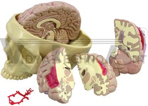 Brain and Partial Skull